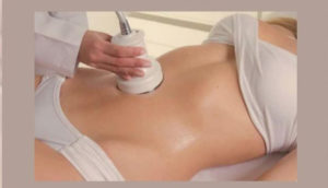 Lipocavitation
